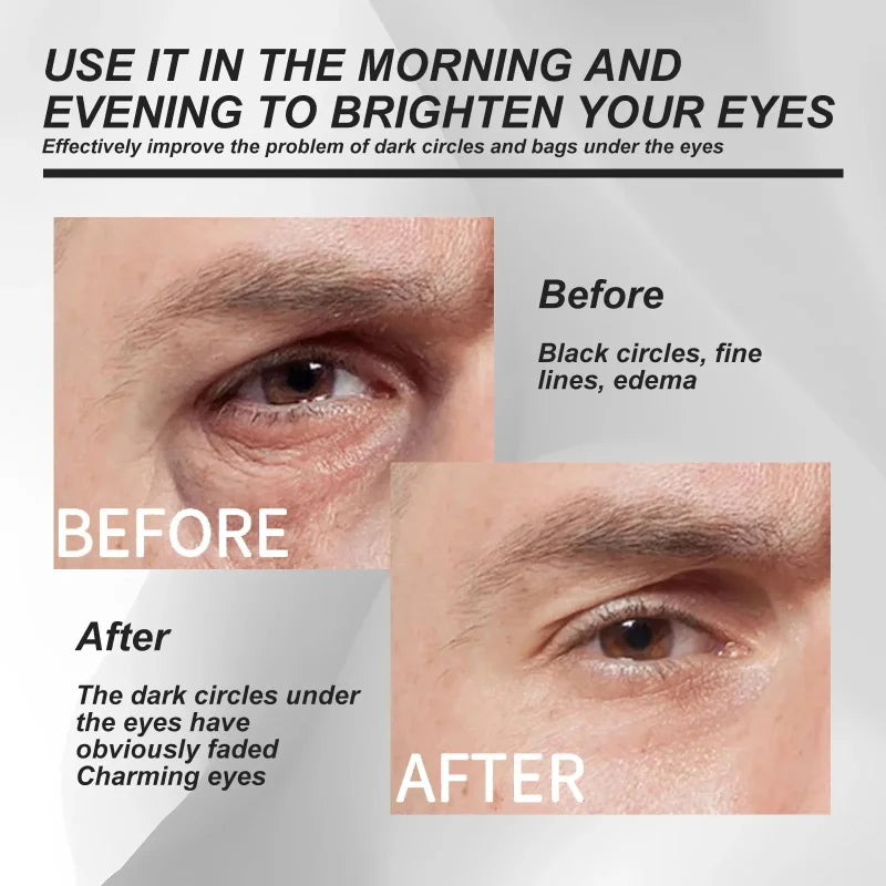 SADOER Glutathione Multi-Brightening Eye Cream Niacinamide Suitable for Sensitive Skin Firms and Reduces Dark Circles Qme