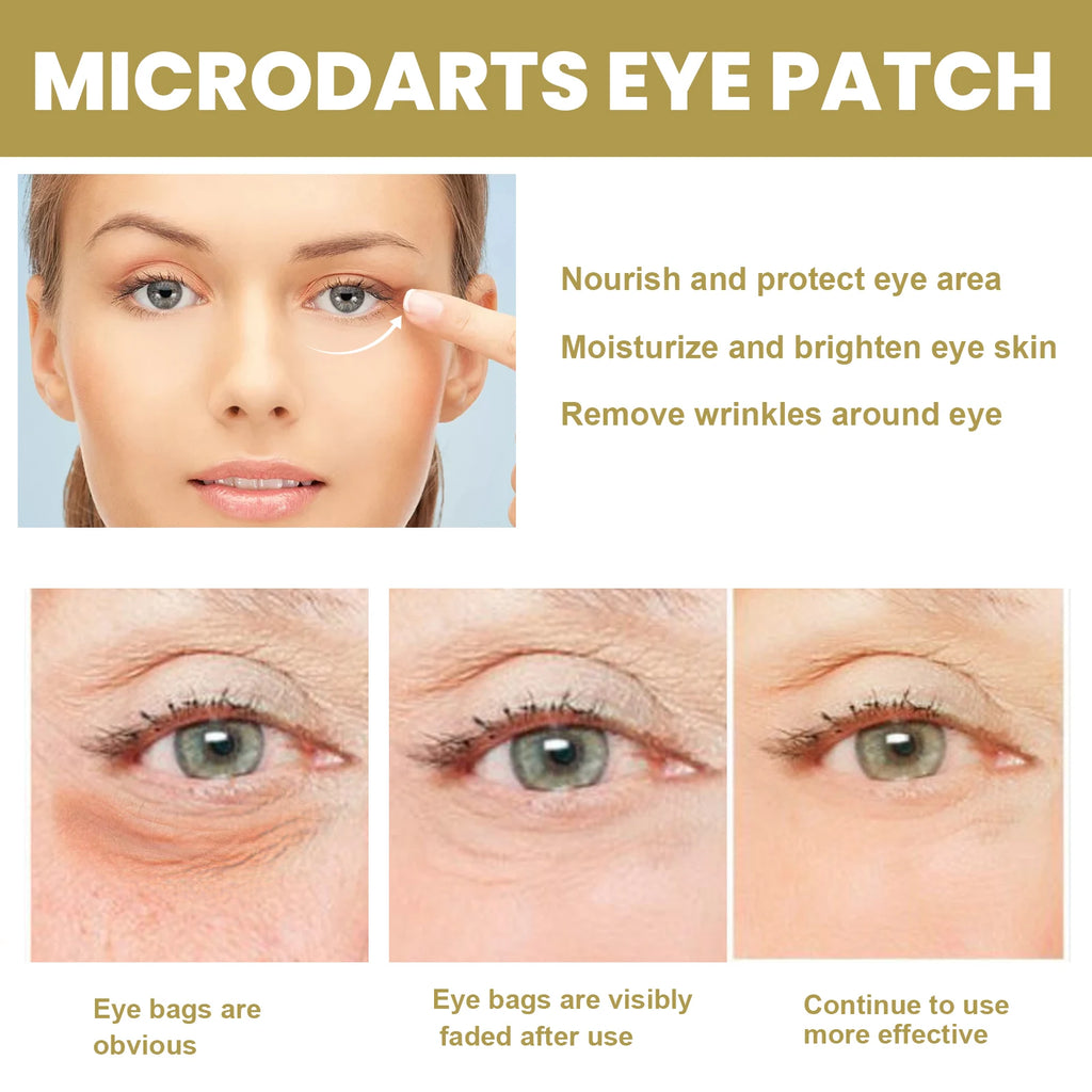 Hyaluronic Acid Microneedle Eye Patches Reduces Dark Circles & Puffiness Fade Fine Lines Under Eyes Nourishes Delicate Eye Skin Qme