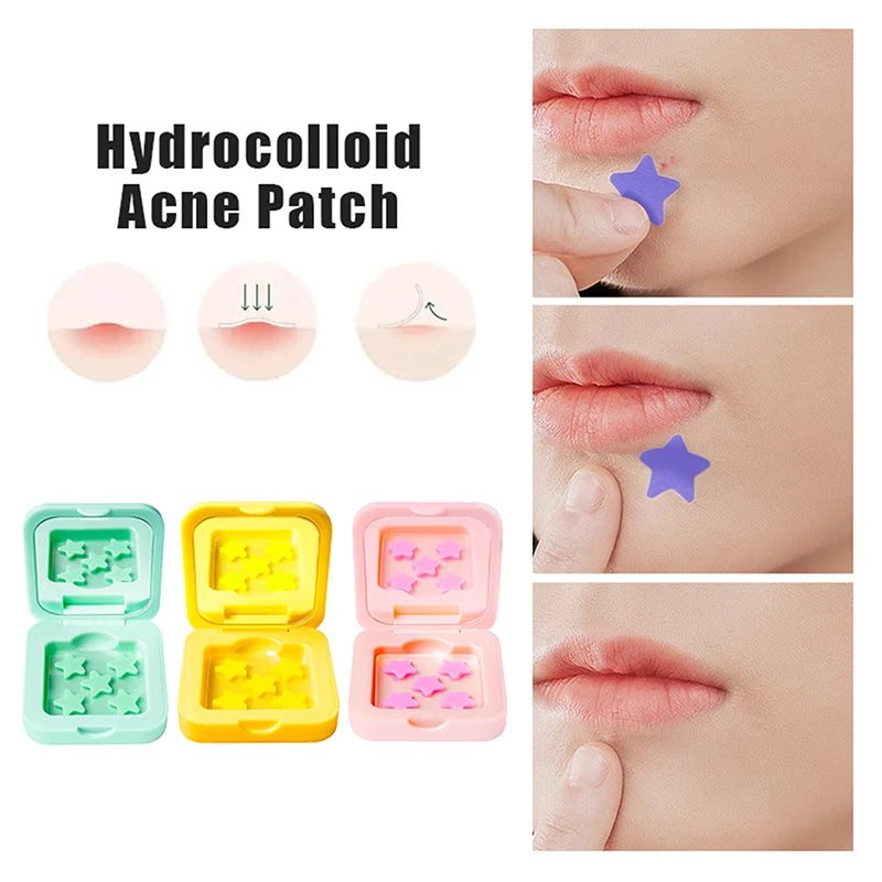 1Box 25 48 Patches Hydrocolloid Acne Patch Fade Repair Invisible Qme