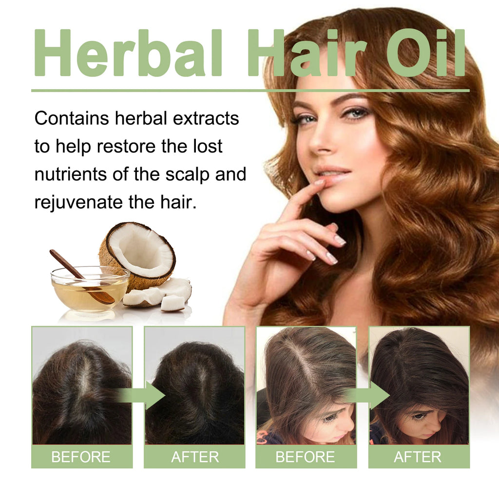 100ml Hair Growth Oil India Adivasi Herbal Hair Care Rosemary Repair Damaged Hydrate Moisturize Scalp Reduce Dandruff Qme