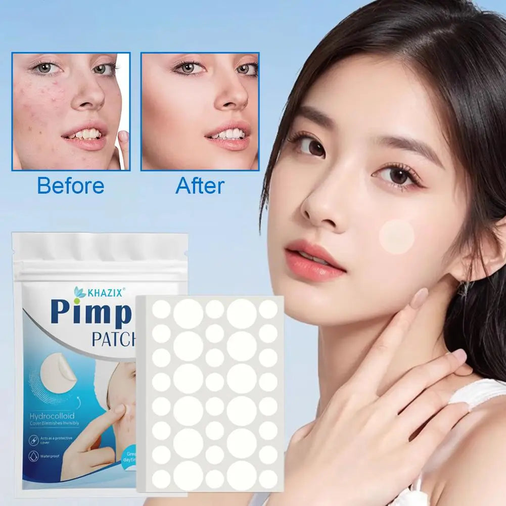 Transparent Acne Patch Concealer - Invisible Acne Patch For Women, Mild Skin-Friendly Tool For Face Cleaning, Targets Black X5R8 Qme