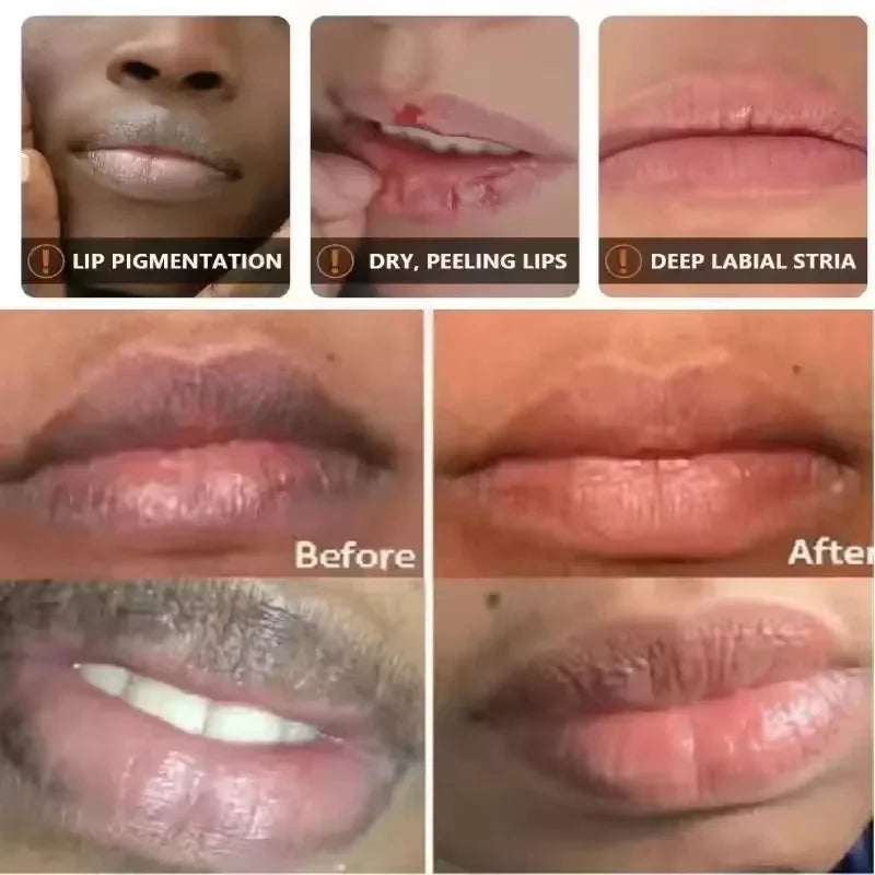 Remove Dark Lip Balm Fast Lightening Pink Lip Exfoliating Fade Lip Line Dead Skin Moisturizer Korean Care Products Beauty Health Qme