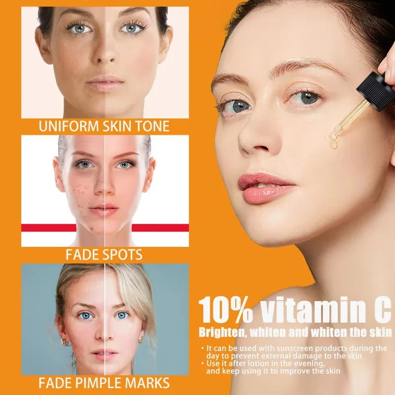 Vitamin C Facial Essence Dark Spot Remover Repair Anti-aging Essence Facial Skin Care Repair Collagen Nourish Skin Care Qme