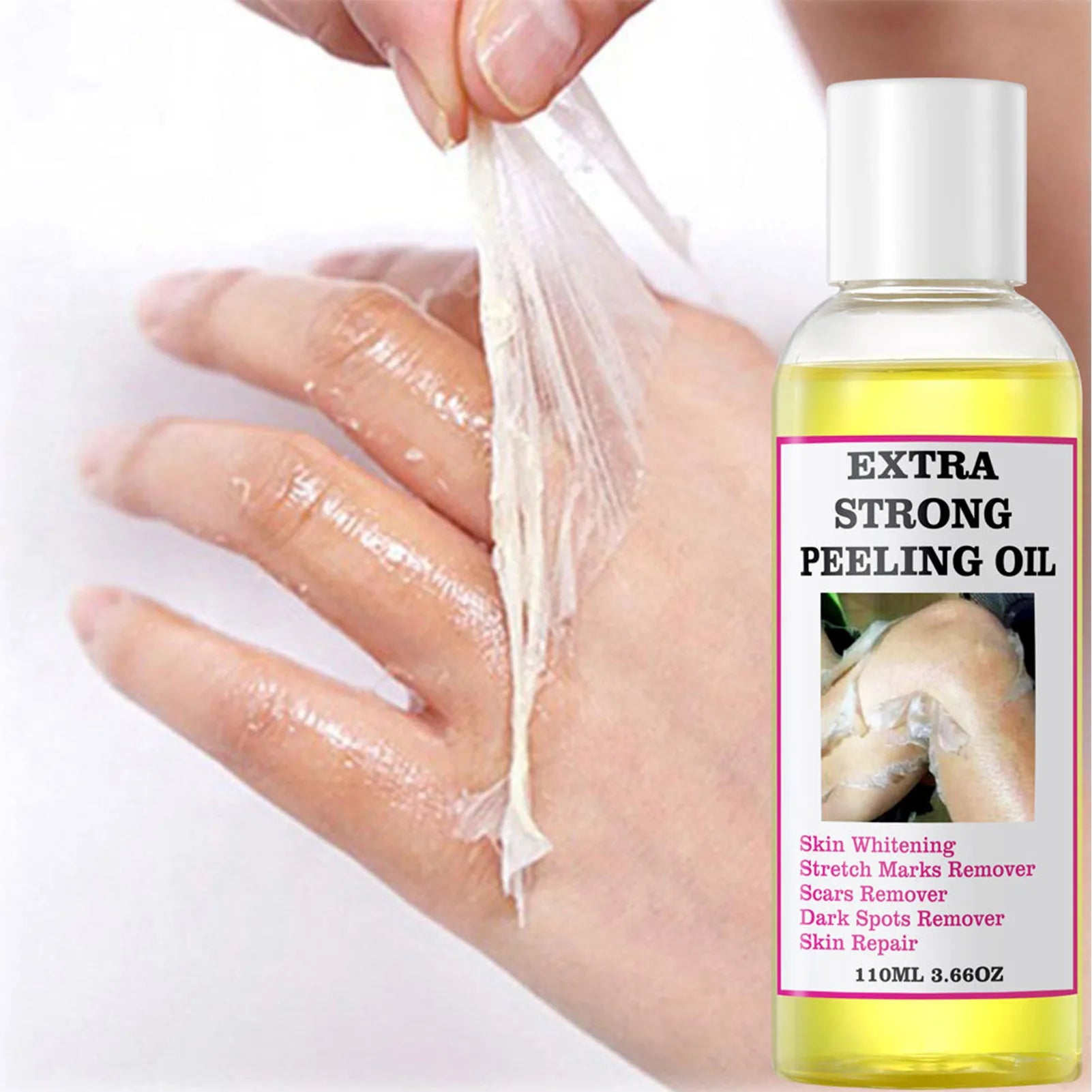 Peeling Oil Yellow Dark Spots Body Thai Hyaluronic Acid Strong Extra Qme