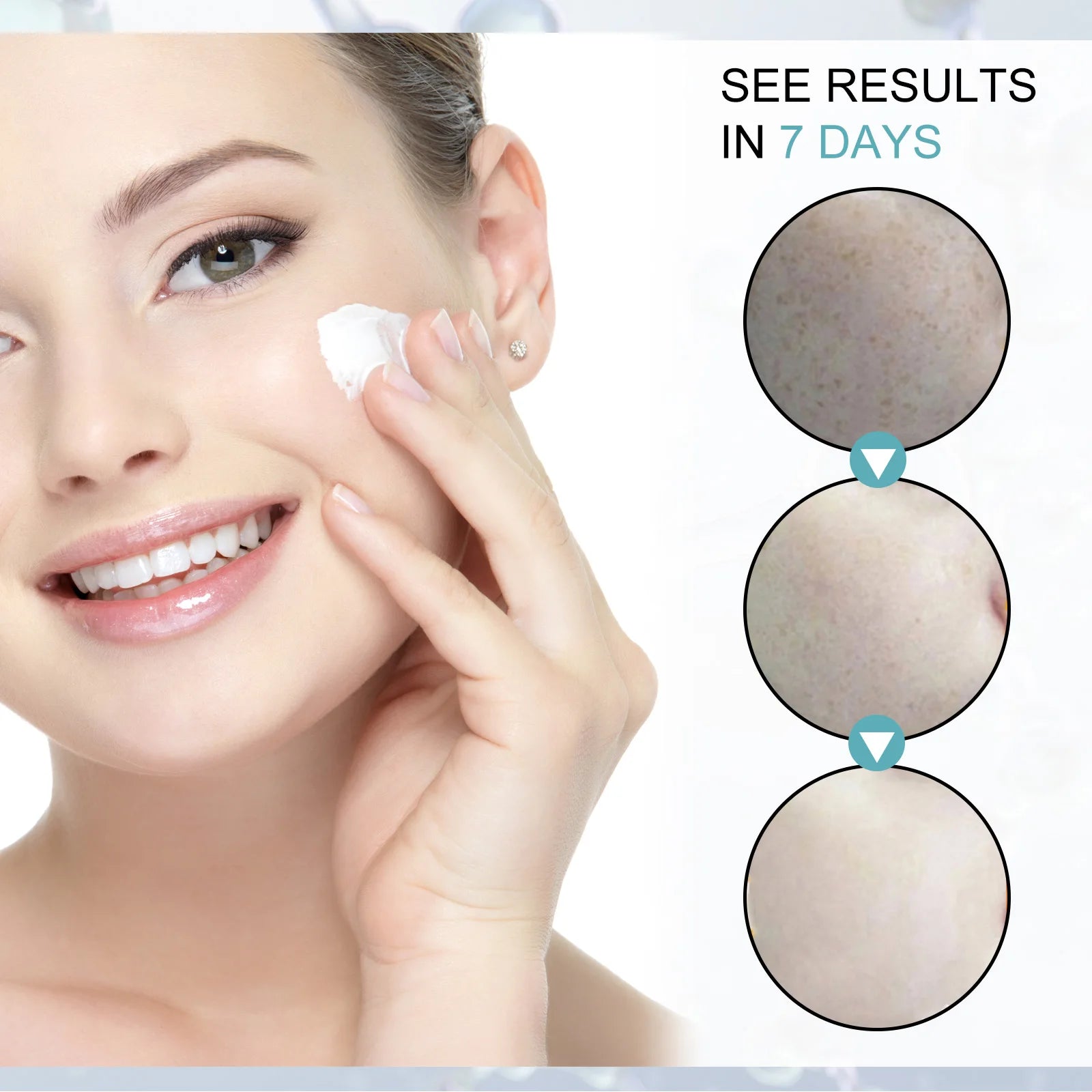 Freckle Whitening Cream Nicotinamide Fade Dark Spot Blemish Acne Mark Brightening Lightening Pigmentation Correction Cream Qme