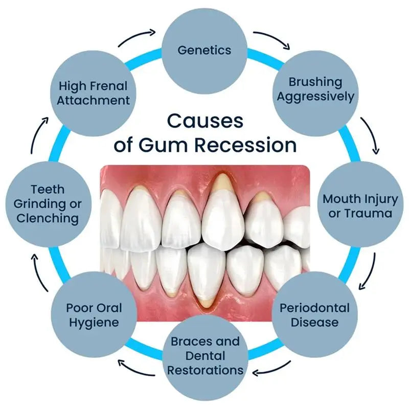 Gum Repair Care Gel Relieve Sore Gum Improve Gingival Damaged Inflammation Cleaning Teeth Stains Tartar Whitener Gum Protect Gel Qme