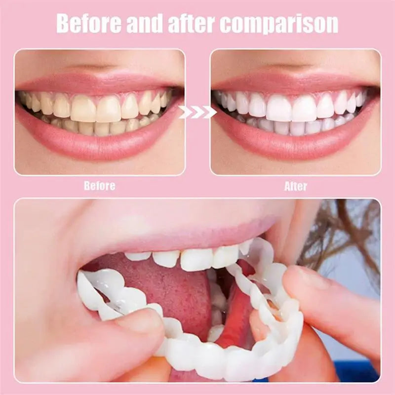 Teeth Veneers Tooth Cover Dentures Dental Snap Fake Instant Qme