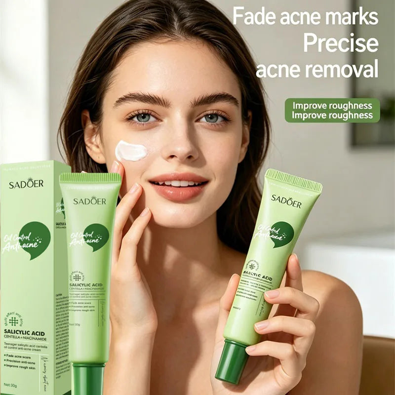 Salicylic Acid Acne Treatment Face Cream Repair Pimple Spots Deep Cleaning Pore Anti-acne Scar Oil Control Moisturizer Skin Care Qme