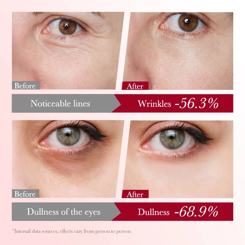 Sakura Collagen Eye Cream Hydrating Firming Brightening Reduces Dark Qme