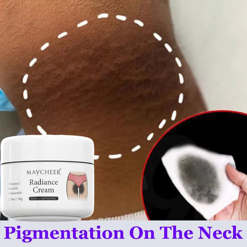 Whitening Cream Private Parts Underarm Bleaching Serum Whiten Butt Knee Brighten Inner Thigh Intimate Parts Dark Remove Melanin Qme