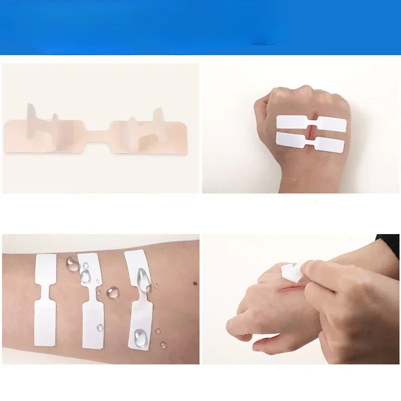 Adhesive Bandages Emergency Kit Butterfly Adhesive Wound Closure Waterproof Band Aid 10PCs/Box Qme