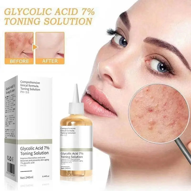 Glycolic Acid 7 Toning Solution Remove Acne Moisturize Skin Qme