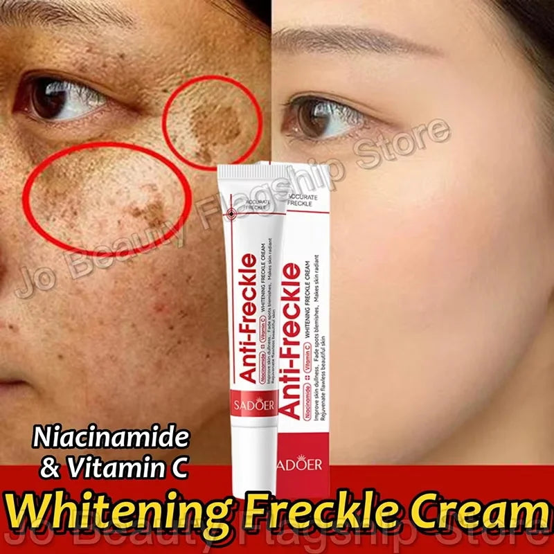 Whitening Freckle Cream Reduce Dark Spots Anti Freckle Face Creams Niacinamide Fade Pigmentation Melasma Brighten Skin Care 20g Qme