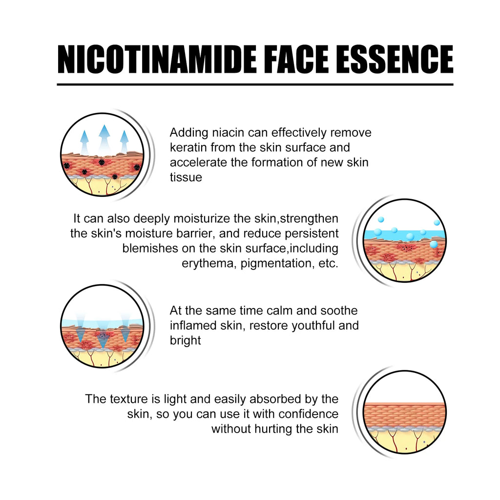 Niacinamide Face Serum Brightening Lighten Dark Spots Acne Marks Fade Blemishes Pigmentation Moisturizing Facial Essence Qme