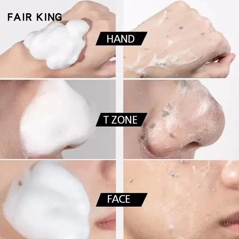 Face Exfoliating Gel Deep Cleansing Pores,Remove Dead Skin Purify Gentle Exfoliate Oil Control Moisturizing Face Scrub Skin Care Qme