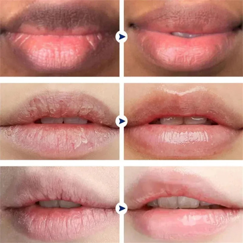Remove Dark Smoke Lip Balm Lightening Melanin Bleaching Gloss Oil Lips Pink Lipstick Exfoliating Fade Lip Lines Korean Cosmetics Qme