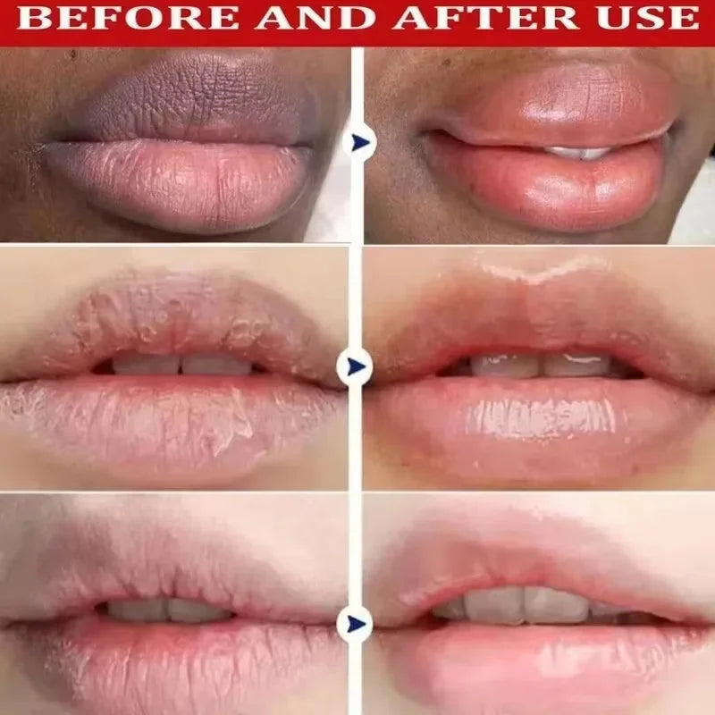 Remove Dark Lip Balm Lightening Melanin Mask Gloss Exfoliating Lip Pink Treatment Reduce Lip Lines Improve Dryness Moisturizing Qme