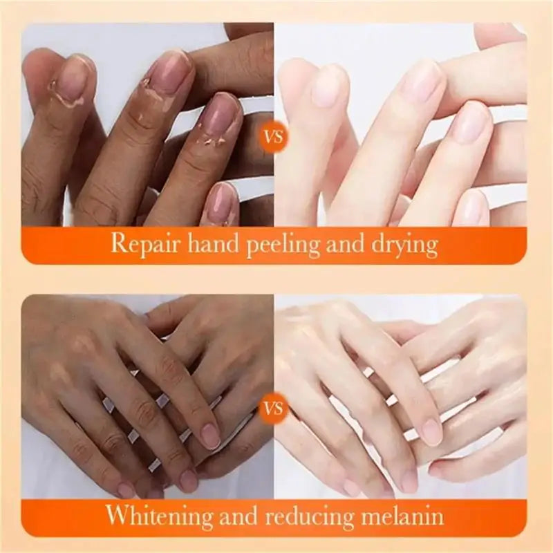 Fast Brighten Dark Knuckles Cream Whiting Hand Cream Lighten Melanin Stains Corrector Hand Anti Crack Soften Moisturize Product Qme