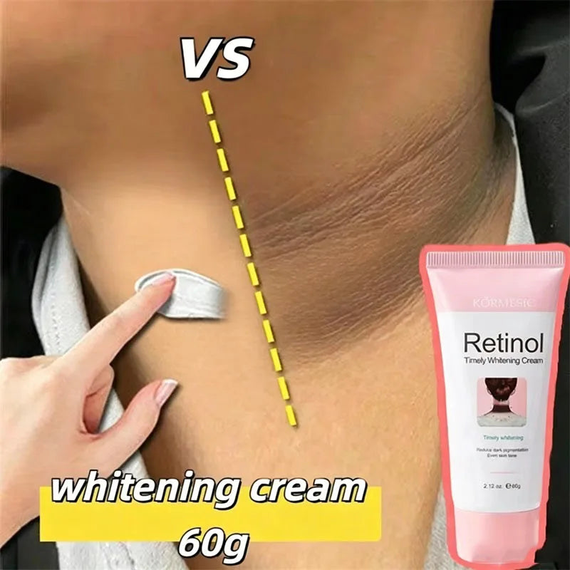 Retinol Whitening Cream Private Parts Underarm Bleaching Neck Lift Firm Butt Knee Brighten Inner Thigh Dark Remove Melanin 60g Qme