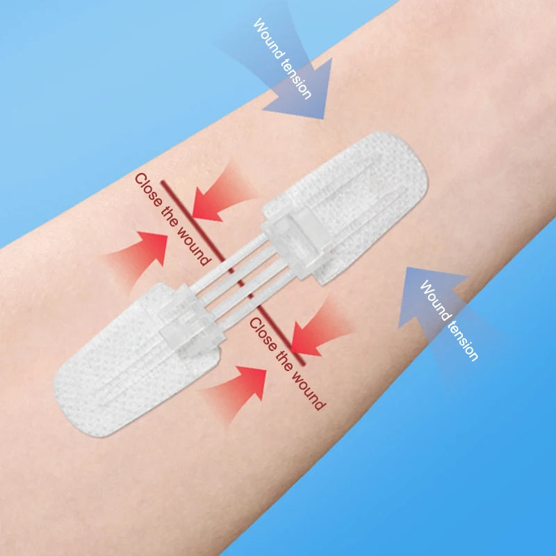 Zipper Band-aid Painless Wound Closure Patch Zip Suture Reducer Band Qme