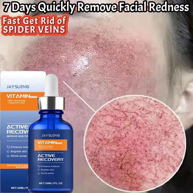 Facial Redness Repair Essence Improve Sensitive Skin Dryness Moisturizer Hydrating Sooth Lotion Removal Rosacea Korean Cosmetics Qme 1pc 1