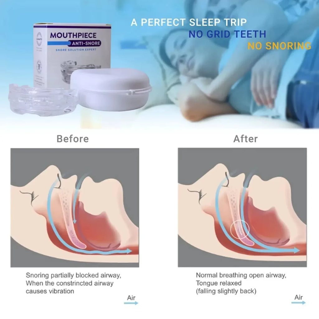 Mouth Guard Anti-snoring Teeth Bruxism Mouthguard Improves Sleep Qme