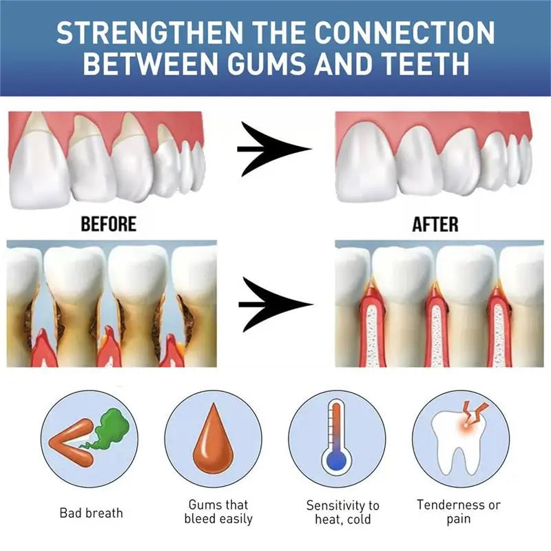 Gum Repair Care Gel Relieve Sore Gum Improve Gingival Damaged Inflammation Cleaning Teeth Stains Tartar Whitener Gum Protect Gel Qme