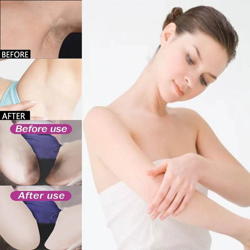 Remove Melanin Nicotinamide Brightening Cream For Dark Skin Effective Lighten Thigh Inner Bleach Private Parts Brighten Cream Qme
