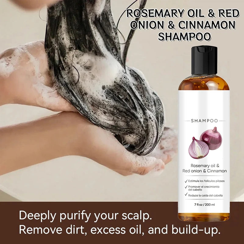 Rosemary Red Onion Hair Care Shampoo Balances Oil Dryness Enhances Qme