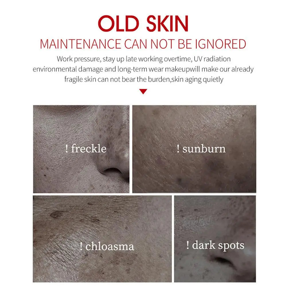 Freckle Remove Cream Whiten Face Firming Moisturizing Anti-wrinkle Qme