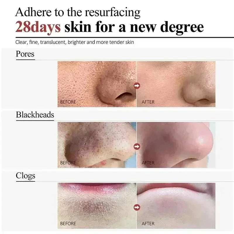 Clean Pores Serum Facial Delicate Tender Moisturizing Oil Control Shrink Pores Rough Skin Smooth Care Brighten Korean Cosmetics Qme