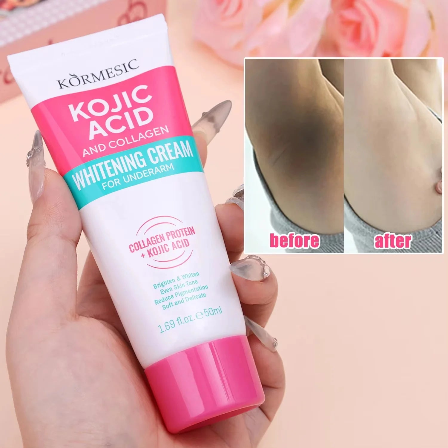 Body Whitening Lotion Dark Spot Remover For Underarms Knees Elbows Melanin Bleaching Lightening Skin Moisturizing Cream Qme 1pc
