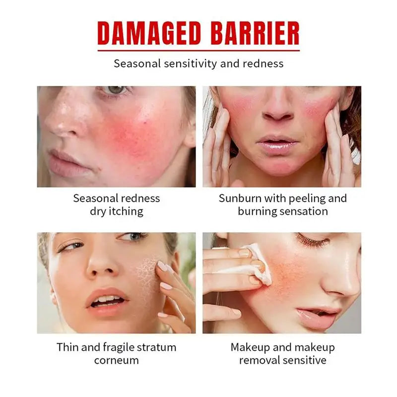 B5 Repair Cream Moisturizing Hydrating Soothing Dry Chapped Redness Skin Nourishes Hydrating Barrier Support Beauty Face Cream Qme