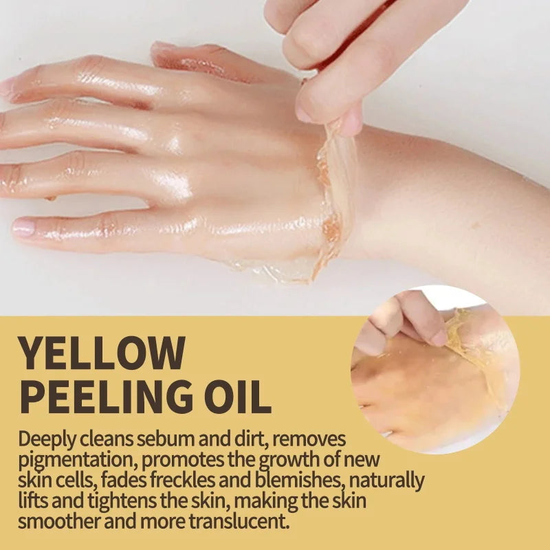 Strong Yellow Peeling Oil Bleach Dark Skin Whiten Lotion Lighten Body Elbow Knee Hand Exfoliate Dead Skin Nourish Even Skin Tone Qme