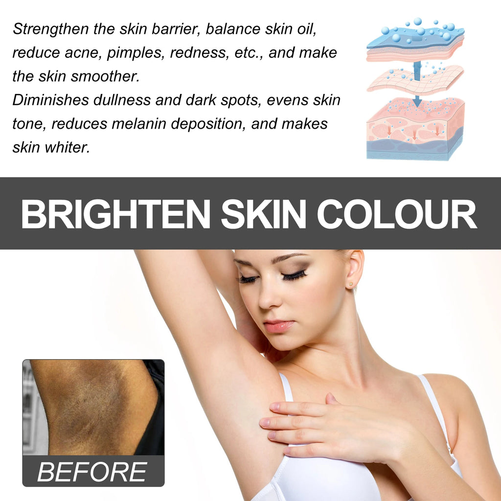Whitening Cream Private Parts Underarm Bleaching Serum Whiten Butt Knee Brighten Inner Thigh Intimate Parts Dark Remove Melanin Qme