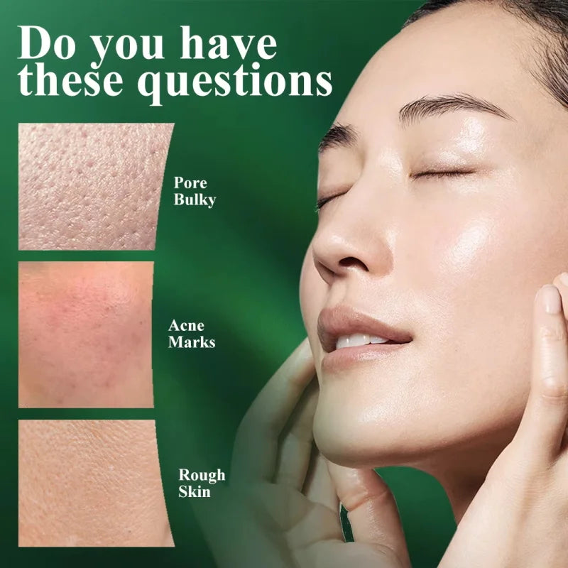 Salicylic Acid Pore Clearing Cream Shrink Pores Remove Blackheads Acne Brighten Moisturizing Smooth Skin Care Korean Products Qme