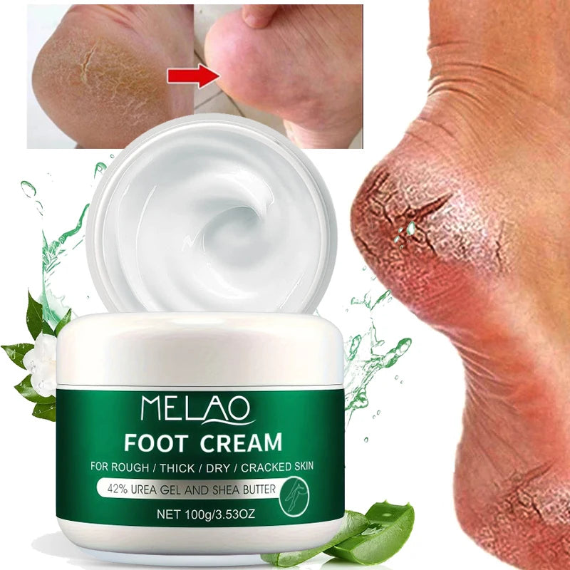 MELAO Urea Cream Salicylic Acid Foot for Dry Cracked Feet Heels Knees Hands Repair Treatment,Moisturizer Dead Skin Remover Qme