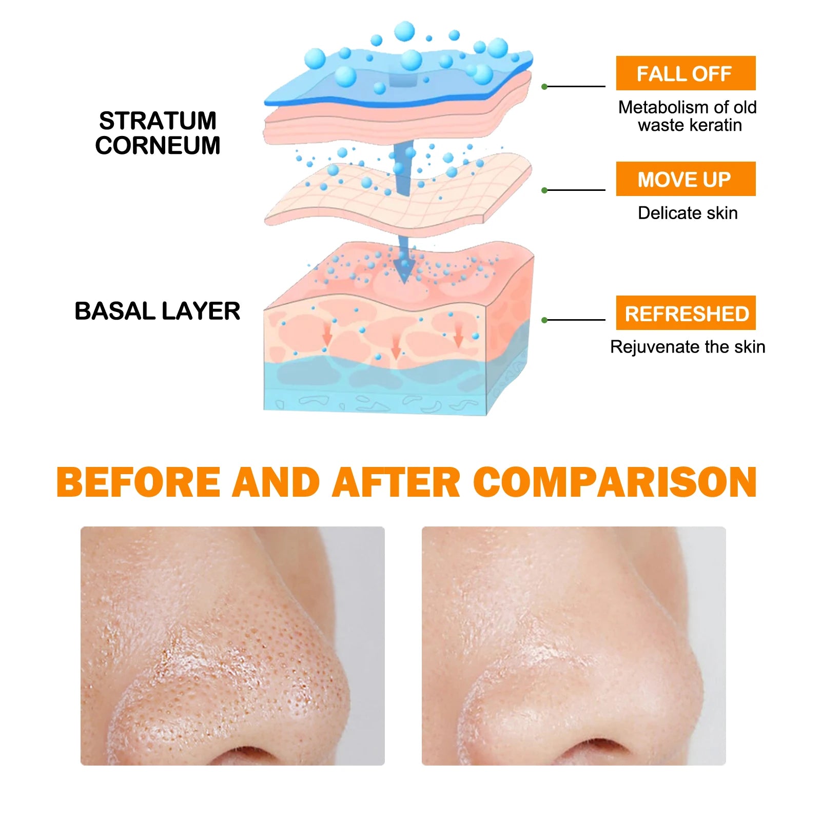 Enzymes Exfoliating Brightening Gel Salicylic Acid Blackhead Dead Skin Remover Cleansing Shrink Pores Brightening Delicate Skin Qme