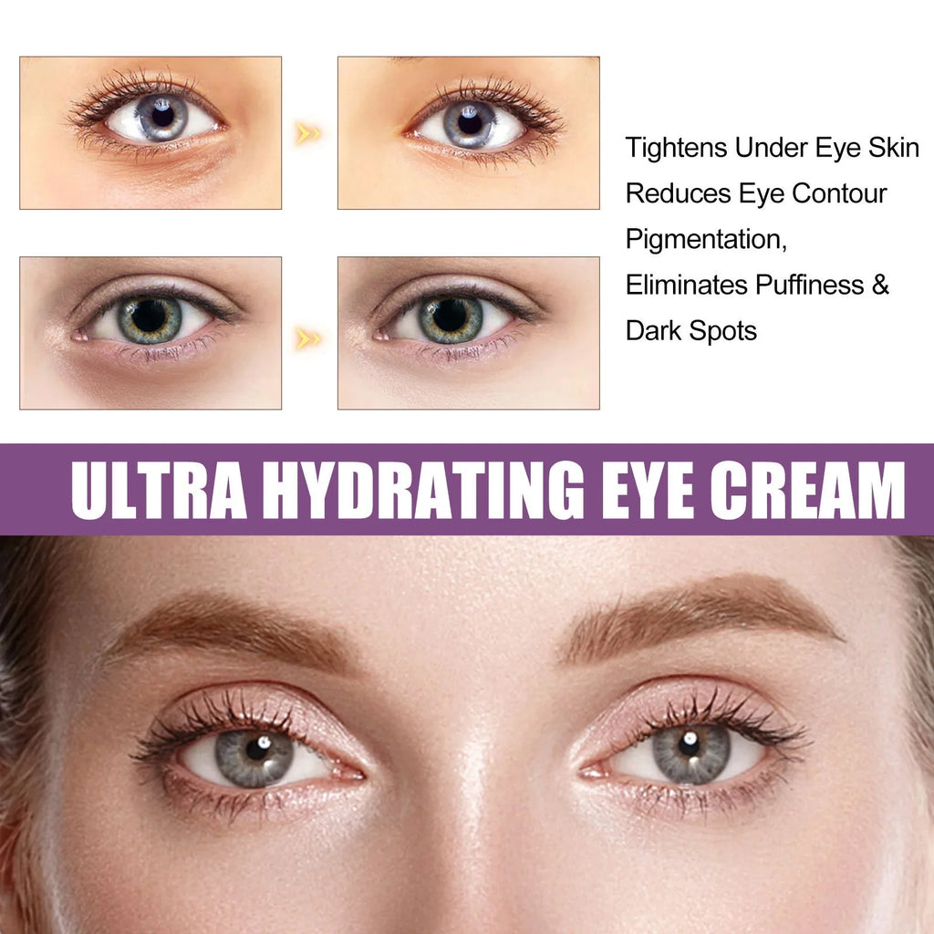 Retinol Firming Eye Cream Reduce Wrinkle Nourishing Faded Dark Circles Improve Eye Bags Puffiness Collagen Niacinamide Cream ﻿ Qme