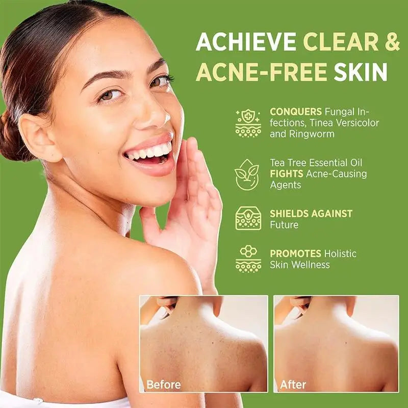 Tea Tree Oil Clean Soothing Soap Gentle Exfoliating Deep Cleansing Qme