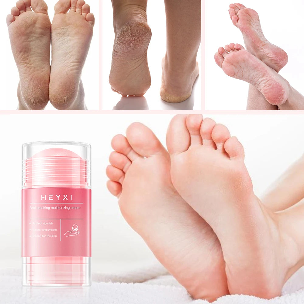 Crack-resistant Foot Cream Suitable Dry Skin Provides Moisture Qme
