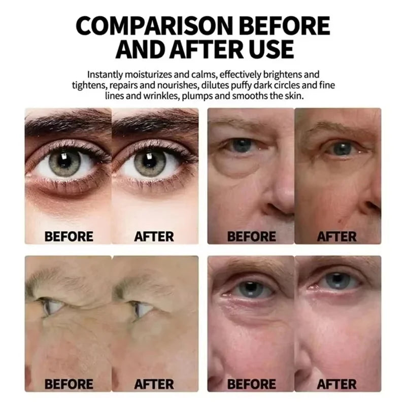 Instant Eye Bag Remove Eye Cream Anti Fat Particles Dark Circles Puffiness Fade Fine Lines Lift Brighten Korean Beauty Eye Care Qme