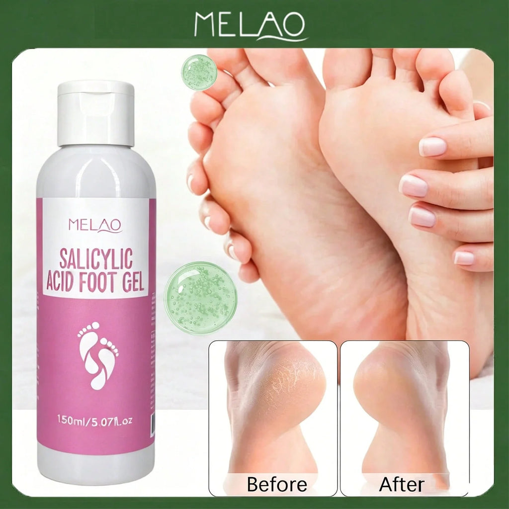 MELAO Salicylic Acid Foot Gel - Dead Skin & Callus Remover, Exfoliating Treatment for Rough Cracked Feet, Softens Heels, 150ml Qme