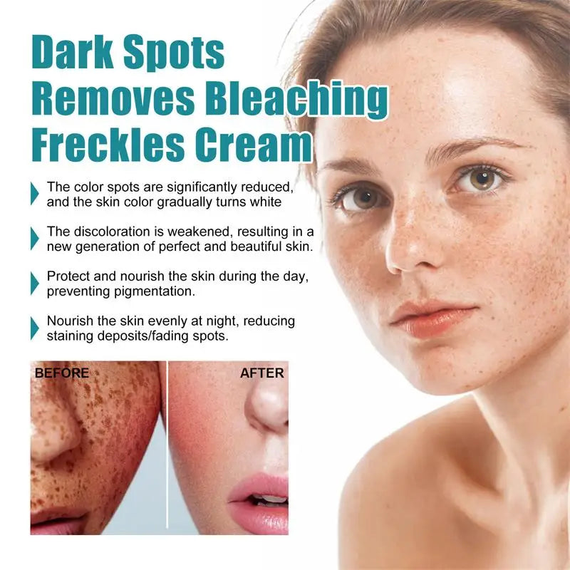 Melasma Brightening Face Cream Niacinamide Serum Brighten Cream Fade Fine Lines Lighten Dark Dot Reduce Melanin Face Skincare Qme