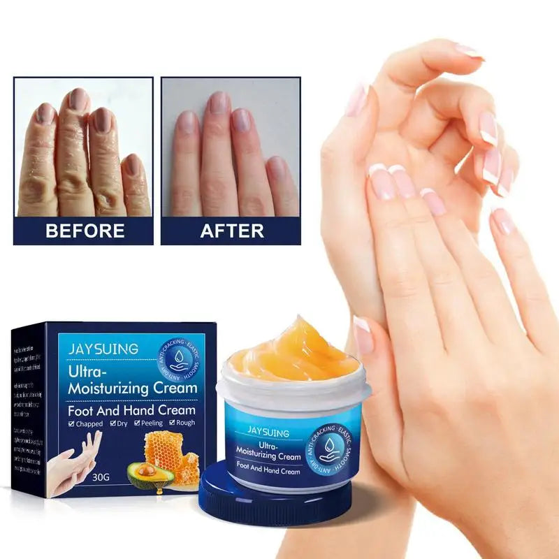 Anti-crack Hand Care Cream Dry Cracked Hands Moisturizing Not-greasy Qme