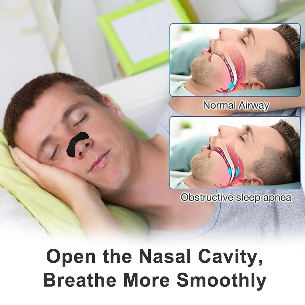 30 90 150 Anti Snoring Nose Strips Breathing Correction Physical Qme