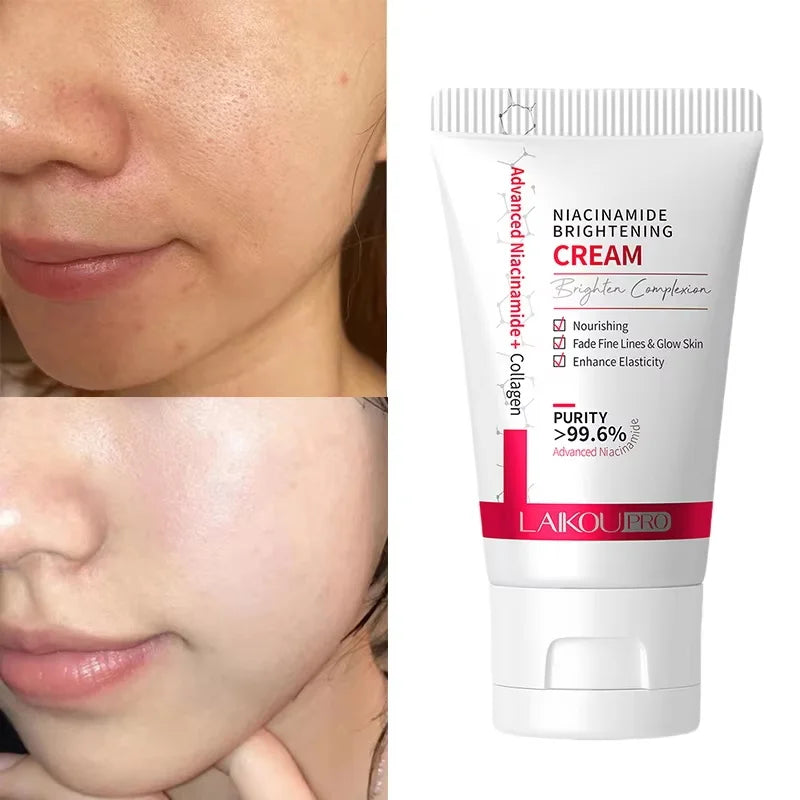 Laikou Niacinamide Whitening Cream Oil Control Oil Control Anti-wrinkle Moisturizing Facial Cream Korean Skin Care Cosmetics 30g Qme 1pc
