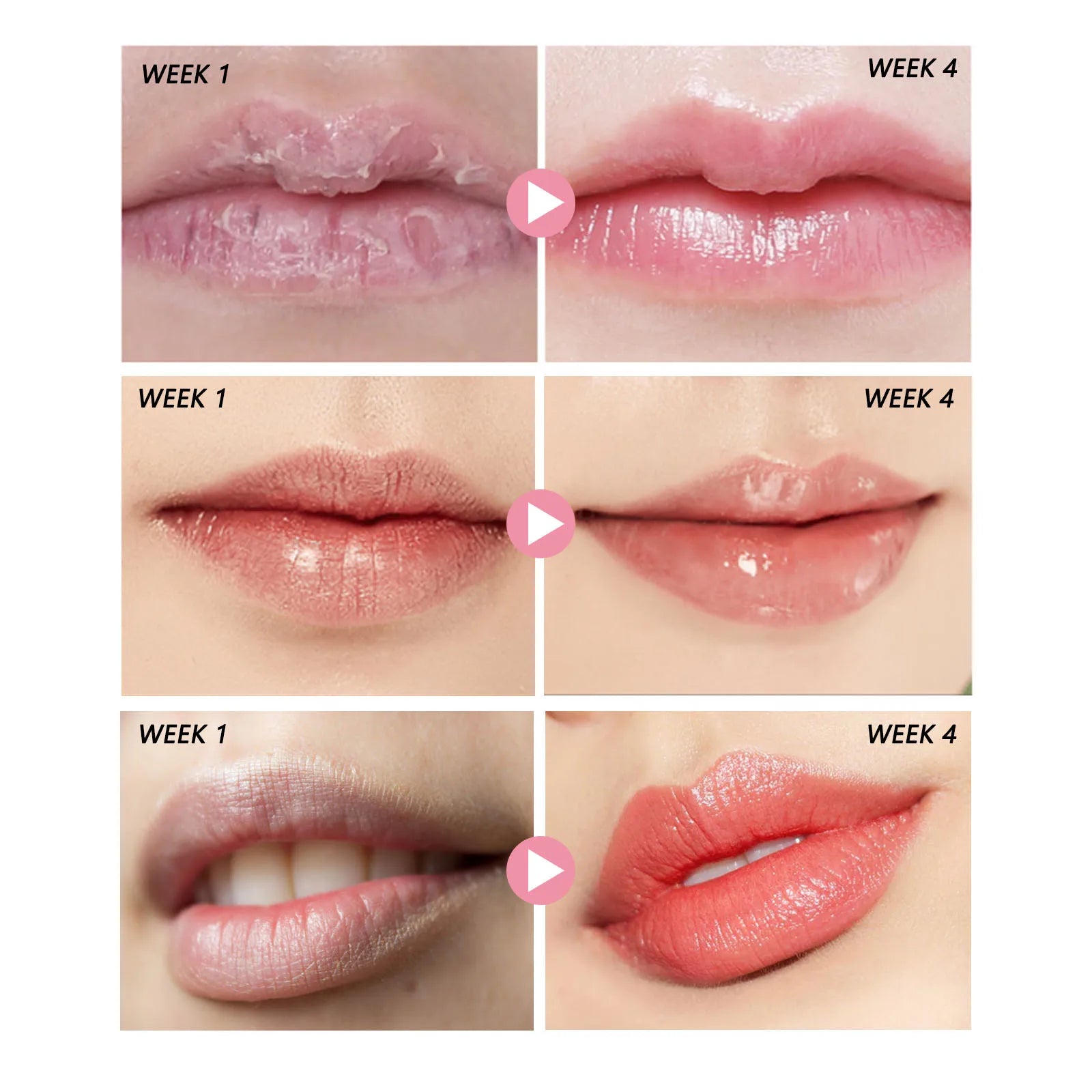 Peach Lip Scrub Moisturizing ＆ Moisturizing Lips Preventing Drying ＆ Cracking Diminishing ＆ Improving Dark Skin Around Lips 30g Qme