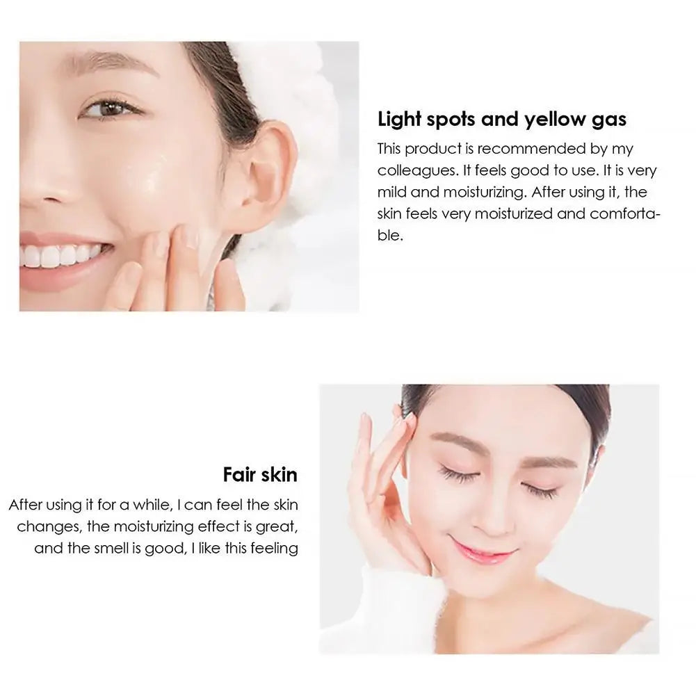 Whitening Cream Anti Freckle Face Remove Blackmelasma Dark Spot Acne Qme