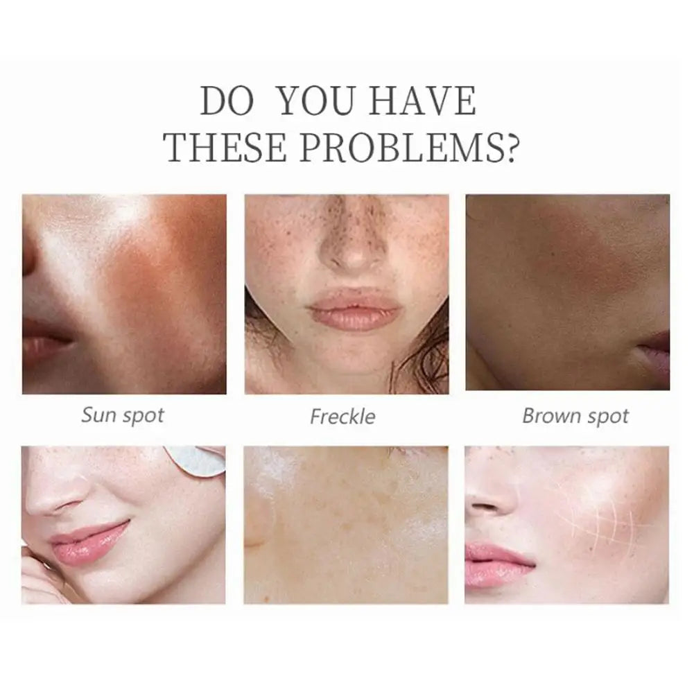 Collagen Kojic Acid Cream Facial Serum Moisturizing Nourish Damaged Qme